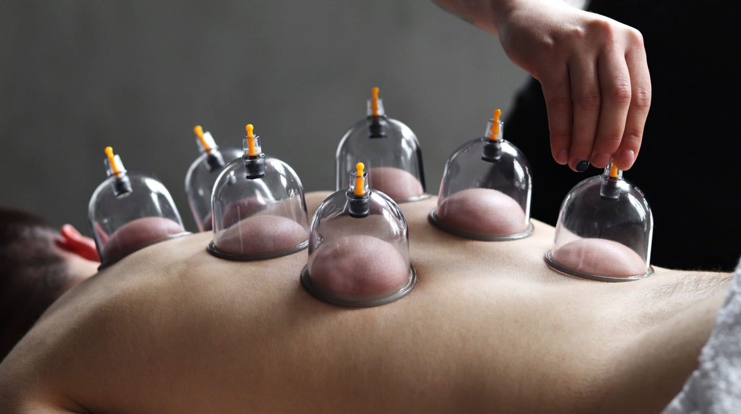 Cupping